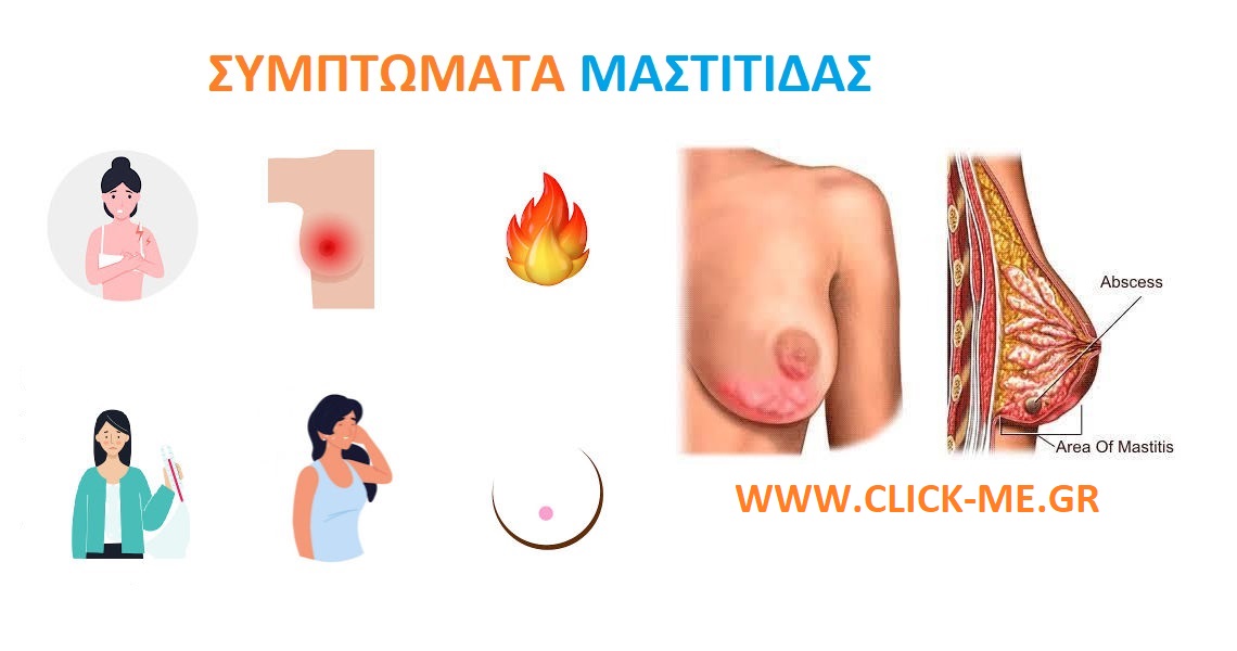 Συμπτώματα μαστίτιδας κατά το θηλασμό